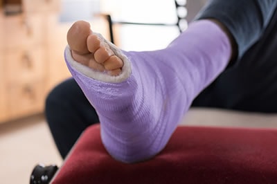 Foot and ankle fractures treatment in the Fairport Harbor, OH 44077, Perry, OH 44081, Solon, OH 44139, Pepper Pike, OH 44124, Kirtland, OH 44094, Willoughby Hills, OH 44094, Highland Heights, OH 44143, Mayfield Village, OH 44143, South Euclid, OH 44121, Oakwood, OH 44146, Shaker Heights, OH 44120 areas