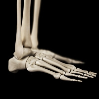 Corns and Calluses