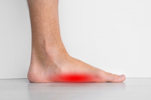 Stretching Flat Feet
