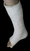 Pregnancy and Foot Health