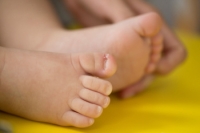 Understanding Ingrown Toenails in Children