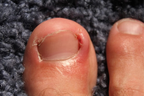 What is a Podiatrist?